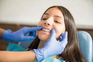 Length of orthodontic treatment